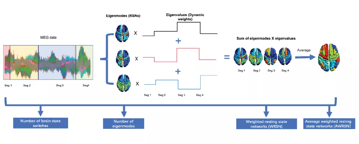 Brain network image