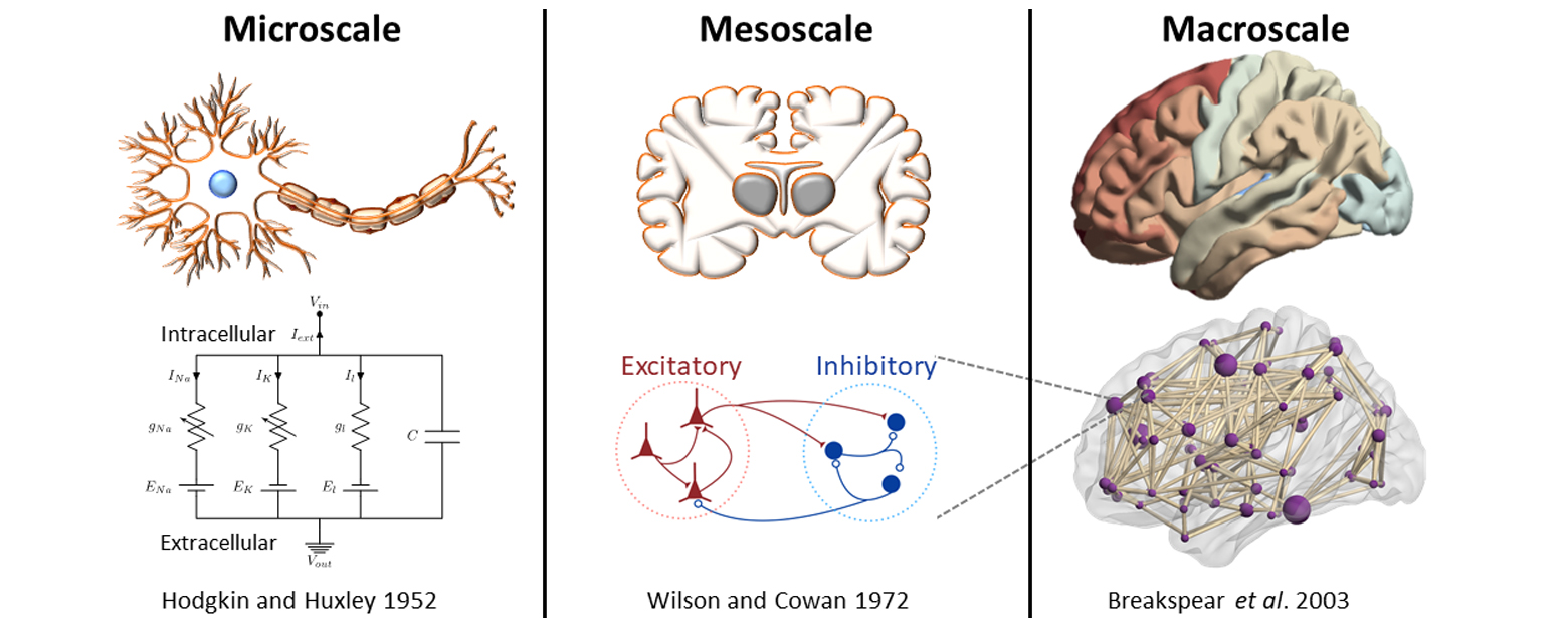 Brain network image